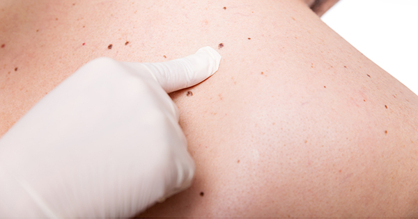 BUENAS NOTICIAS PARA PACIENTES CON ENFERMEDADES DERMATOLÓGICAS